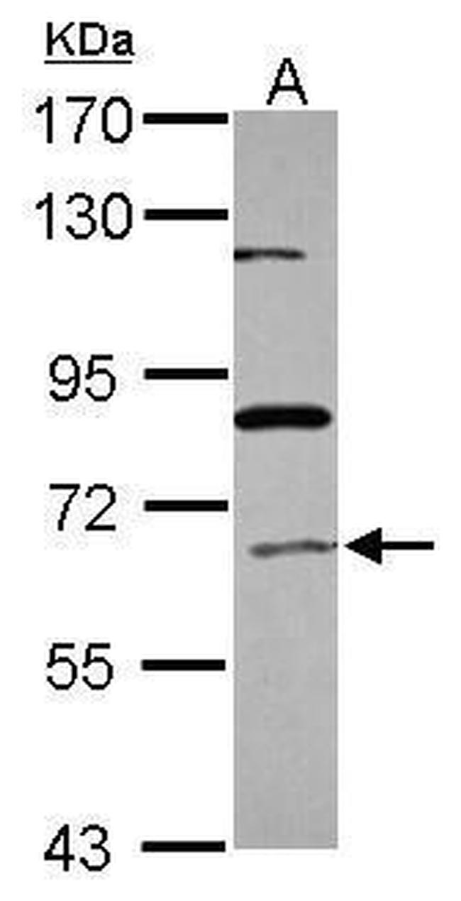 ACOX1 Antibody in Western Blot (WB)