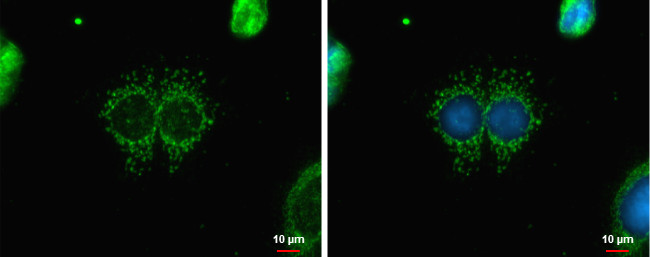 CABC1 Antibody in Immunocytochemistry (ICC/IF)