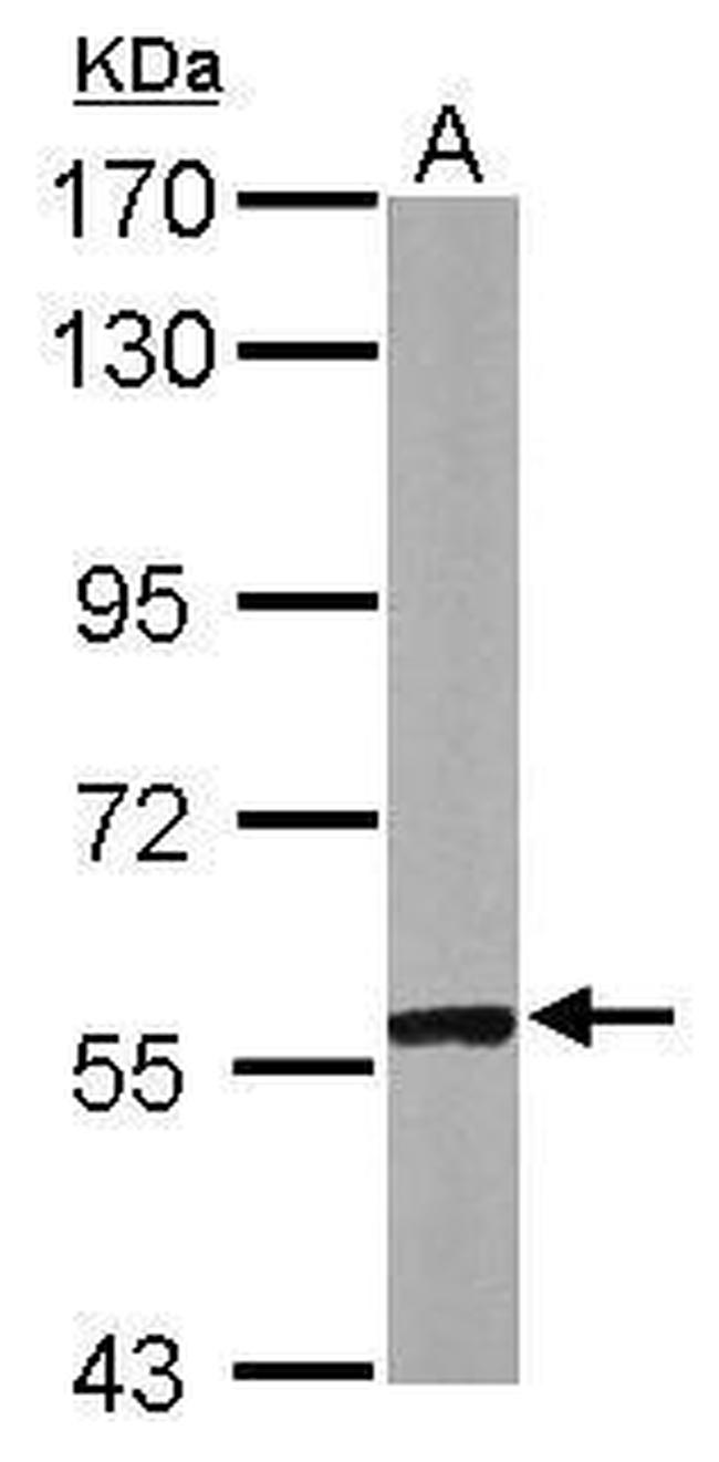 CABC1 Antibody in Western Blot (WB)