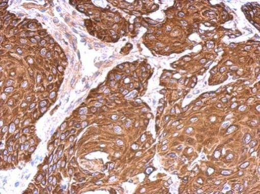 Cytokeratin 6 Antibody in Immunohistochemistry (Paraffin) (IHC (P))