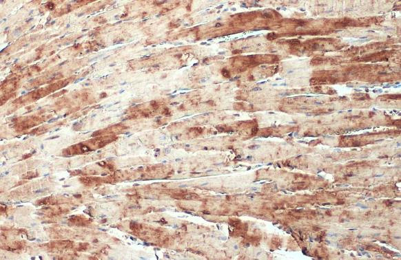 CSRP3 Antibody in Immunohistochemistry (Paraffin) (IHC (P))