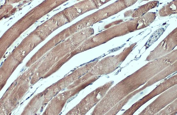 CSRP3 Antibody in Immunohistochemistry (Paraffin) (IHC (P))