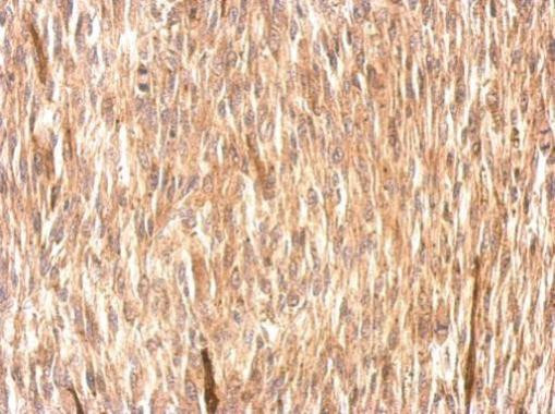 CSRP3 Antibody in Immunohistochemistry (Paraffin) (IHC (P))