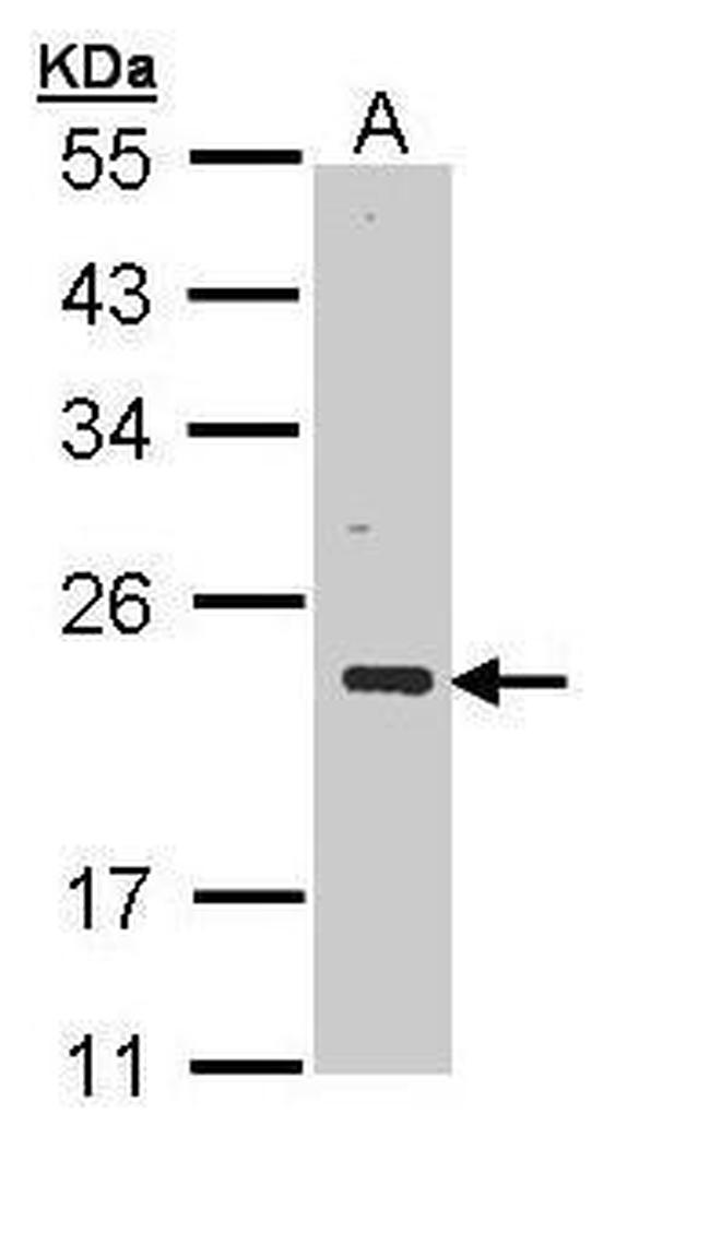 CSRP3 Antibody in Western Blot (WB)