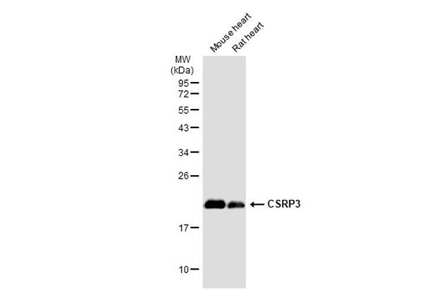 CSRP3 Antibody in Western Blot (WB)