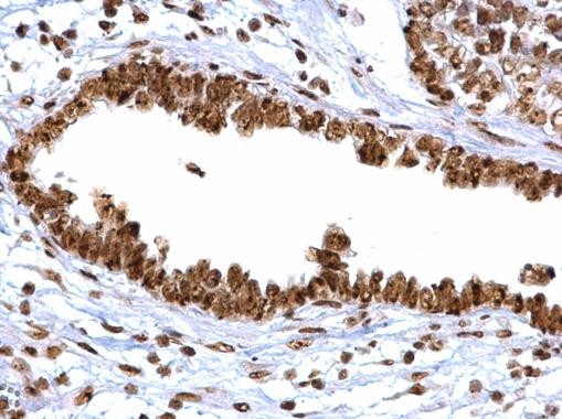 APE1 Antibody in Immunohistochemistry (Paraffin) (IHC (P))