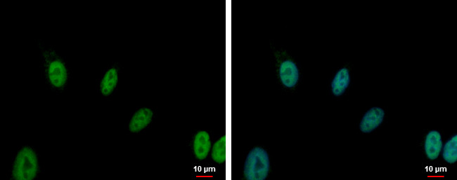 ERCC1 Antibody in Immunocytochemistry (ICC/IF)