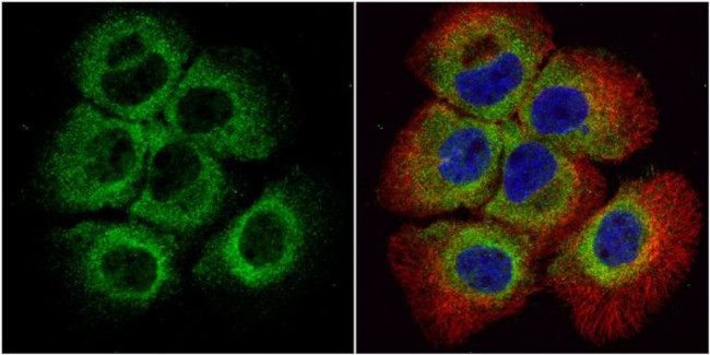 BID Antibody in Immunocytochemistry (ICC/IF)