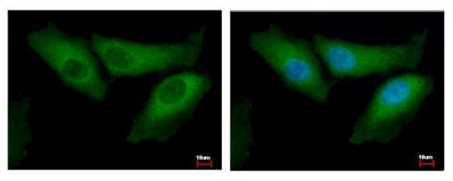 BID Antibody in Immunocytochemistry (ICC/IF)