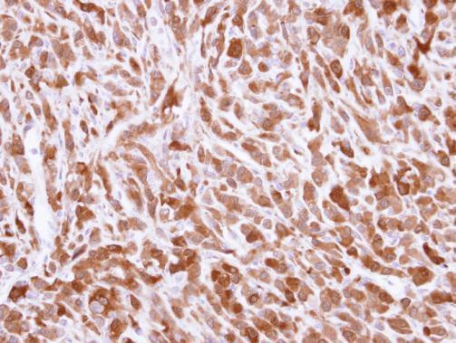 BID Antibody in Immunohistochemistry (Paraffin) (IHC (P))