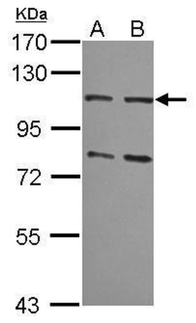 MSH2 Antibody in Western Blot (WB)