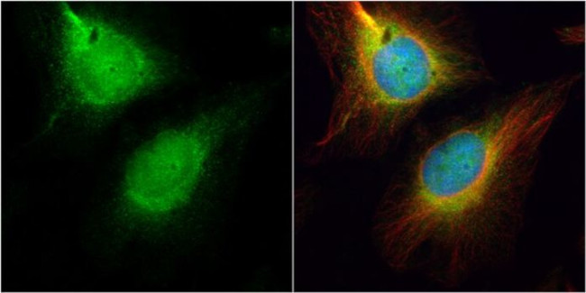 Cdc45L Antibody in Immunocytochemistry (ICC/IF)