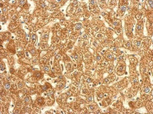 TrxR1 Antibody in Immunohistochemistry (Paraffin) (IHC (P))