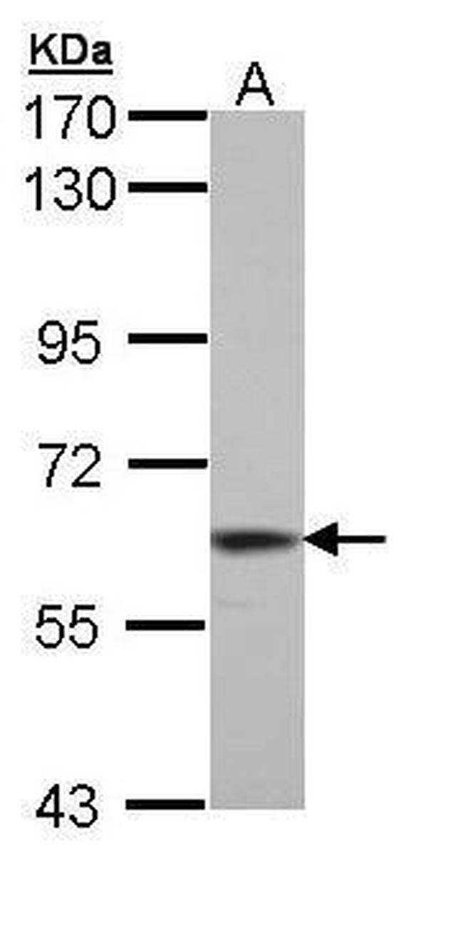 TrxR1 Antibody in Western Blot (WB)