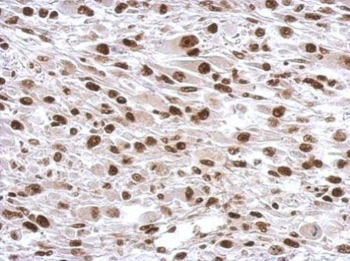 SP1 Antibody in Immunohistochemistry (Paraffin) (IHC (P))