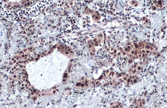 SP1 Antibody in Immunohistochemistry (Paraffin) (IHC (P))