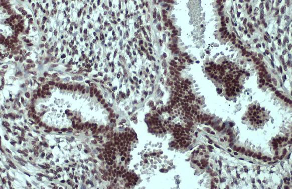 SP1 Antibody in Immunohistochemistry (Paraffin) (IHC (P))