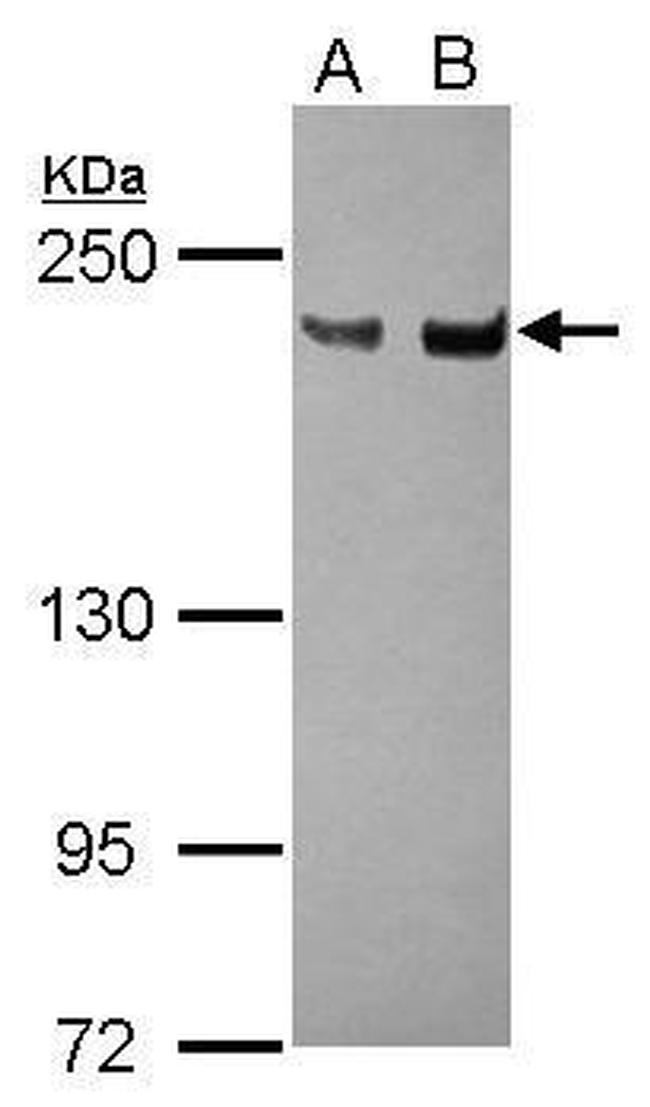 XPG Antibody in Western Blot (WB)