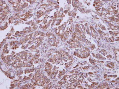 AKT1 Antibody in Immunohistochemistry (Paraffin) (IHC (P))