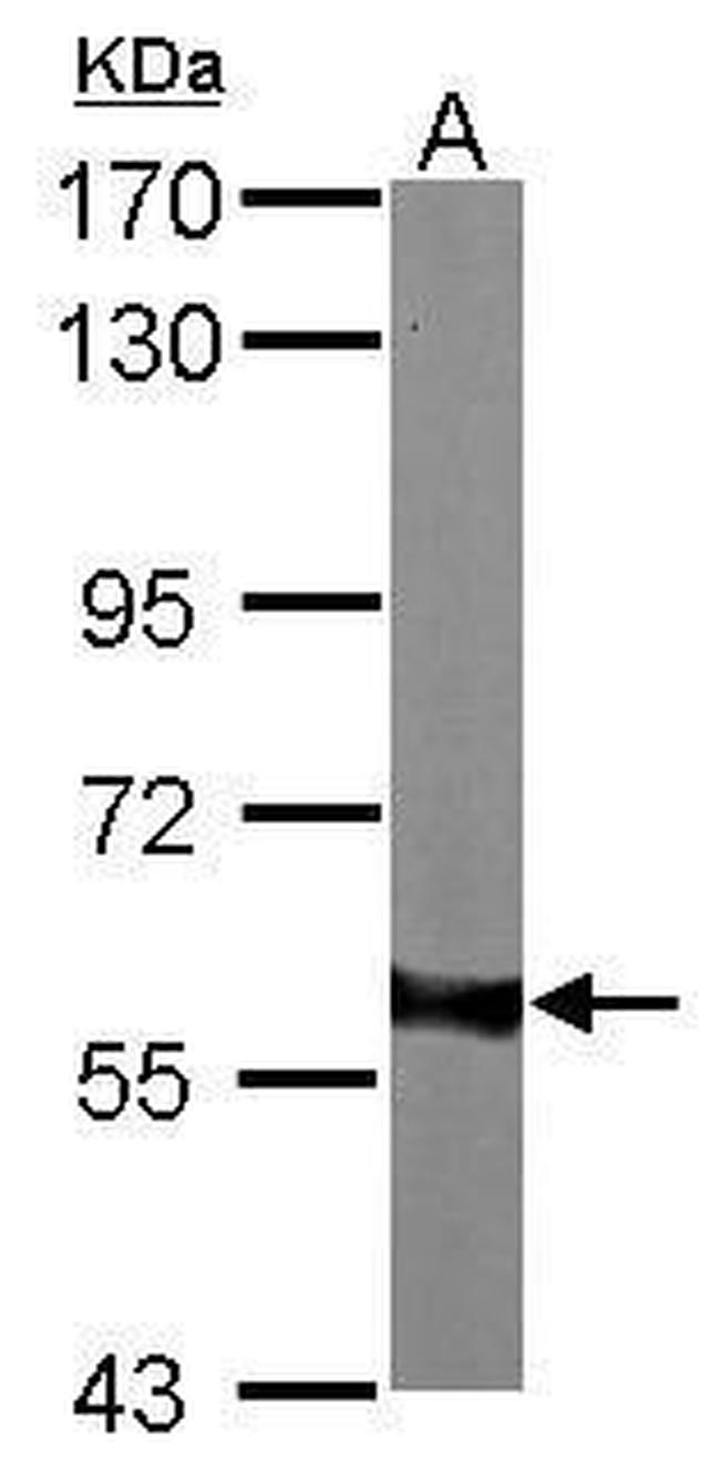 AKT1 Antibody in Western Blot (WB)