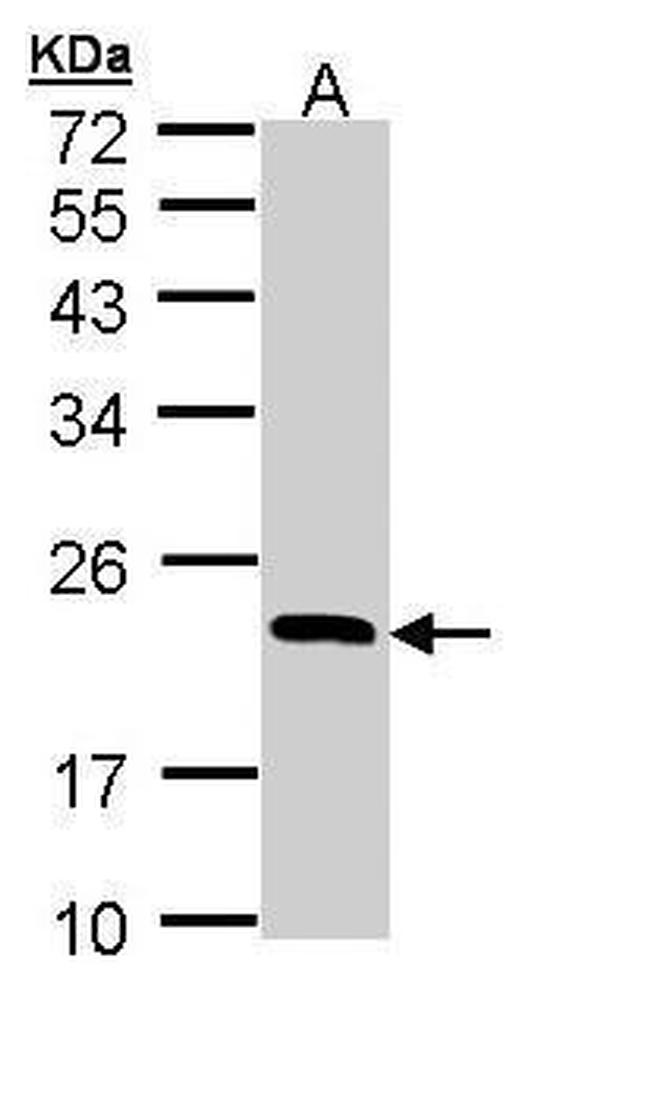 RBP4 Antibody in Western Blot (WB)