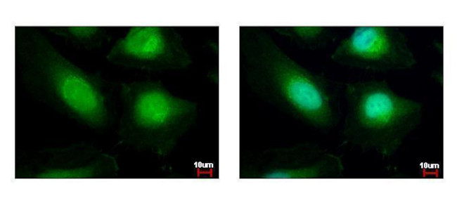 HAT1 Antibody in Immunocytochemistry (ICC/IF)