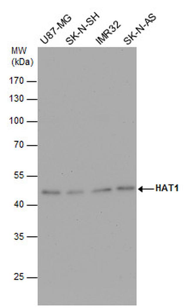 HAT1 Antibody in Western Blot (WB)