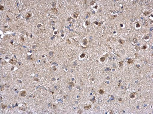 PPT1 Antibody in Immunohistochemistry (Paraffin) (IHC (P))