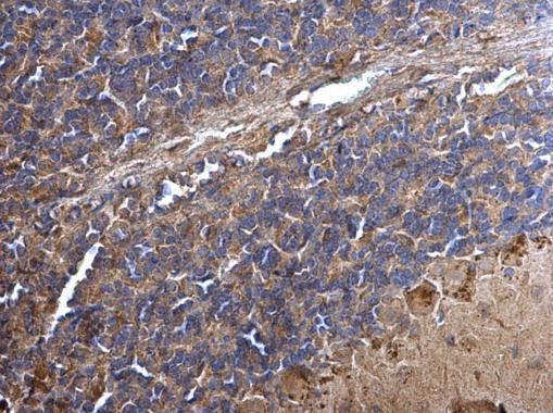 PPT1 Antibody in Immunohistochemistry (Paraffin) (IHC (P))