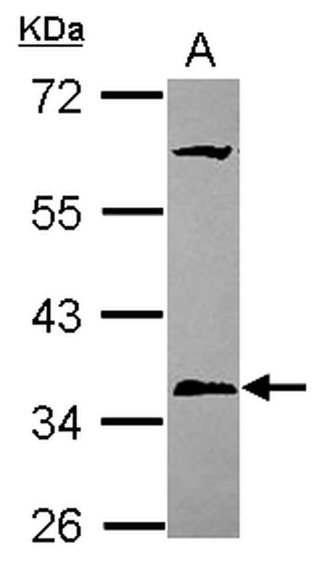 PPT1 Antibody in Western Blot (WB)