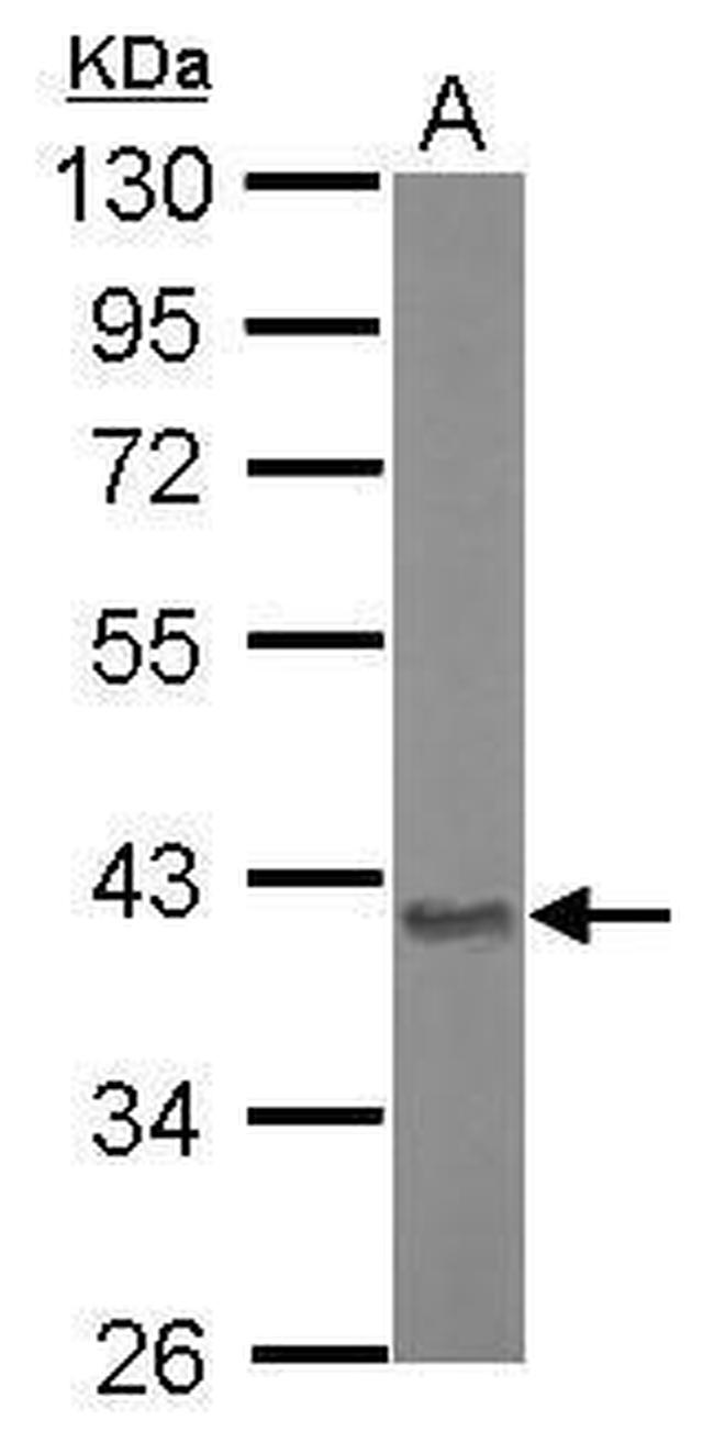 Aspartoacylase Antibody in Western Blot (WB)