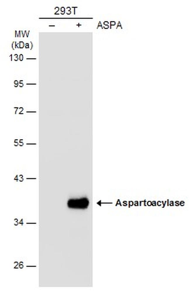 Aspartoacylase Antibody in Western Blot (WB)