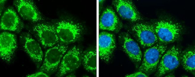 SLC25A22 Antibody in Immunocytochemistry (ICC/IF)