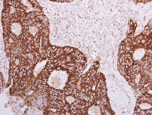 SLC25A22 Antibody in Immunohistochemistry (Paraffin) (IHC (P))