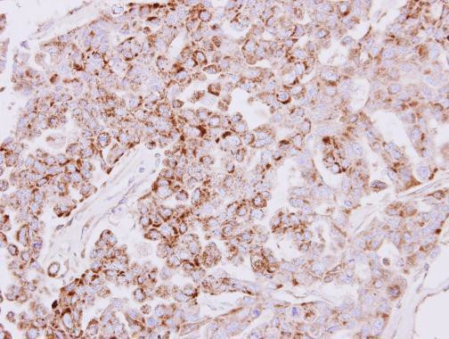 SLC25A22 Antibody in Immunohistochemistry (Paraffin) (IHC (P))