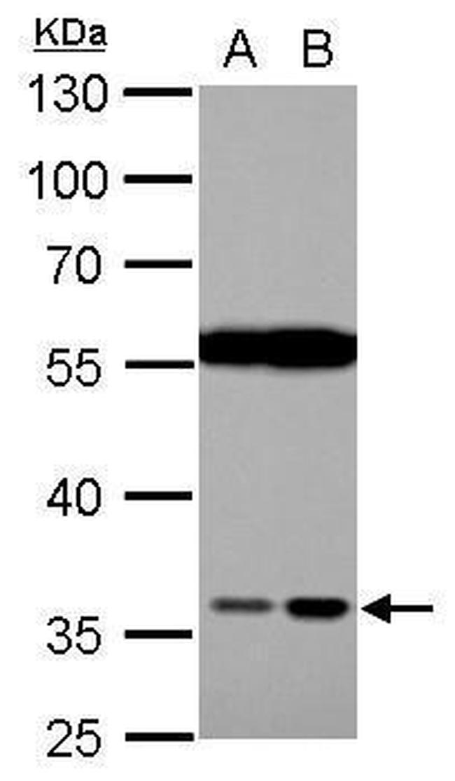 HTRA2 Antibody in Western Blot (WB)