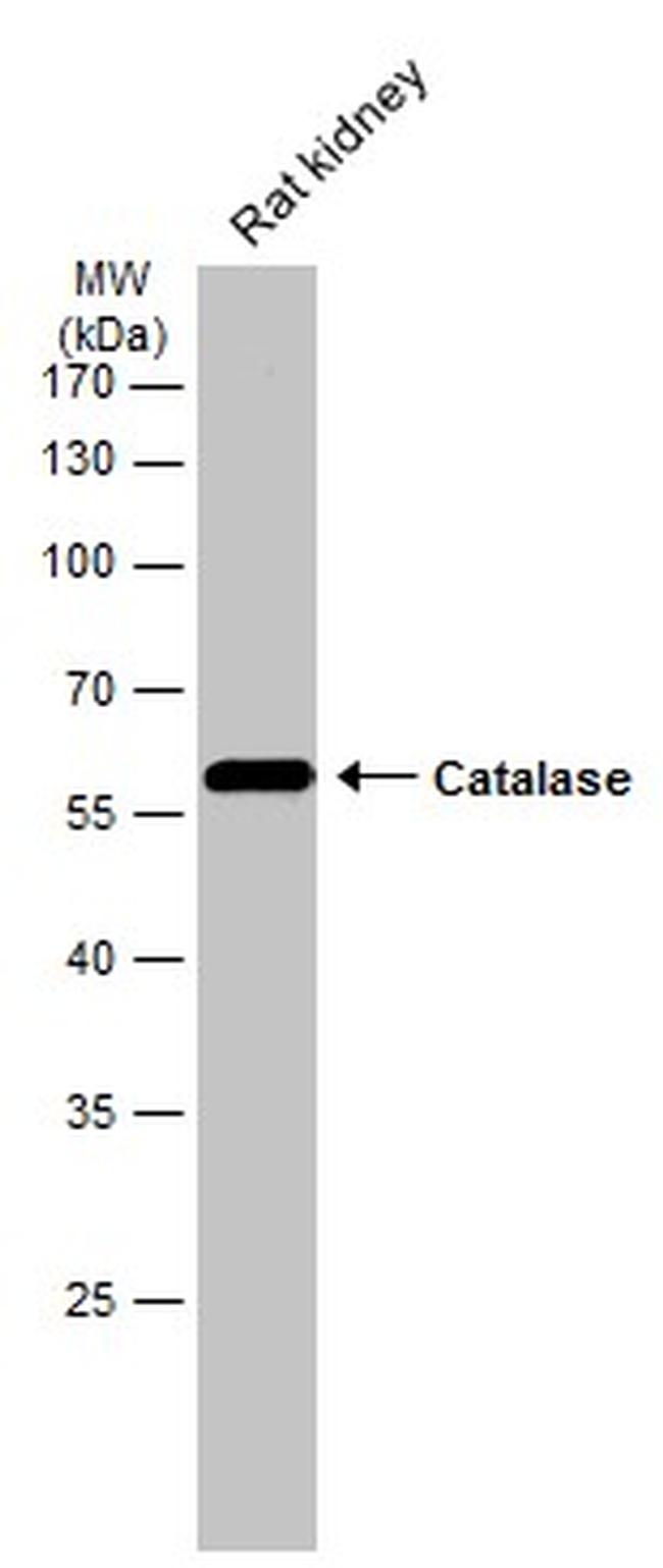 Catalase Antibody in Western Blot (WB)