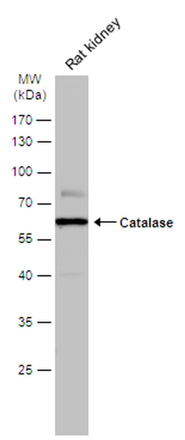 Catalase Antibody in Western Blot (WB)