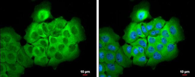 ALDH1A3 Antibody in Immunocytochemistry (ICC/IF)