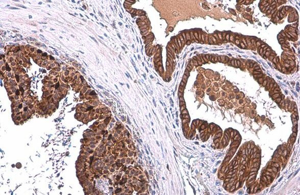 ALDH1A3 Antibody in Immunohistochemistry (Paraffin) (IHC (P))