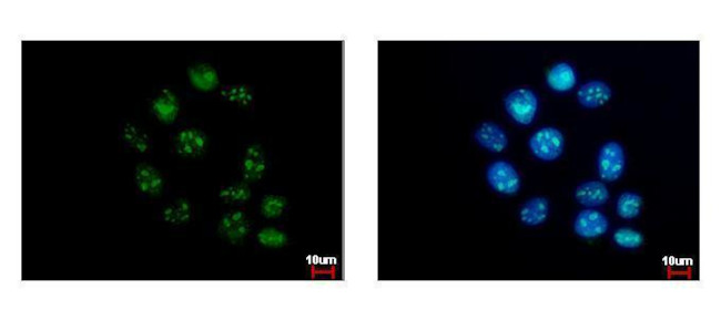 GTPBP4 Antibody in Immunocytochemistry (ICC/IF)