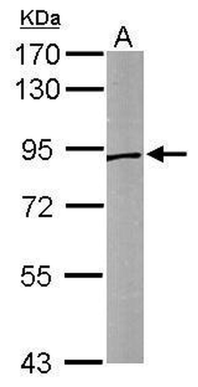 Sortilin Antibody in Western Blot (WB)