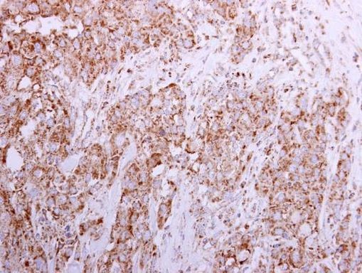 Sortilin Antibody in Immunohistochemistry (Paraffin) (IHC (P))