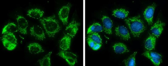 SLC25A6 Antibody in Immunocytochemistry (ICC/IF)