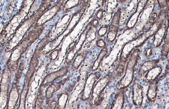 SLC25A6 Antibody in Immunohistochemistry (Paraffin) (IHC (P))