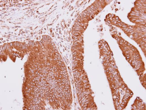 APC10 Antibody in Immunohistochemistry (Paraffin) (IHC (P))