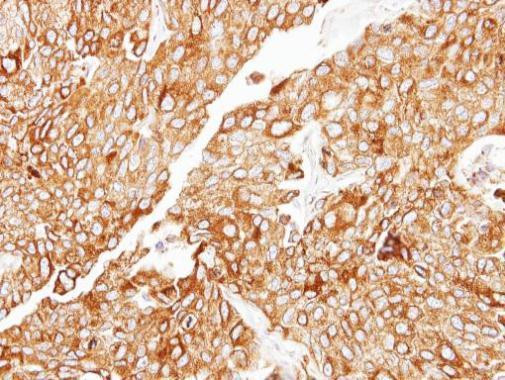 CIDEC Antibody in Immunohistochemistry (Paraffin) (IHC (P))