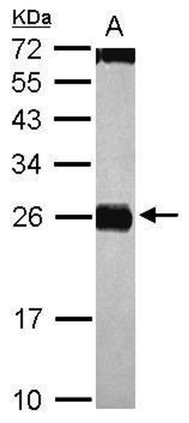 CIDEC Antibody in Western Blot (WB)