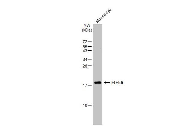 eIF5A Antibody in Western Blot (WB)