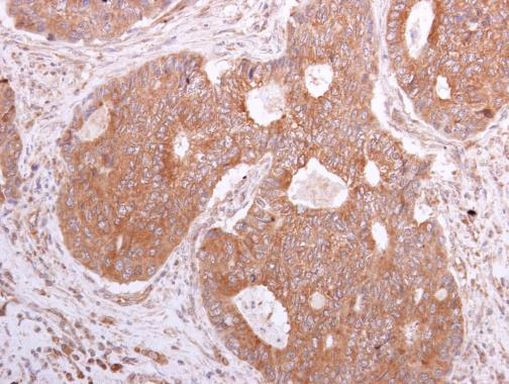 eIF5A Antibody in Immunohistochemistry (Paraffin) (IHC (P))